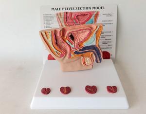 Ciência médica humana pelve masculina Cavidade Doença sagital Anatomia ensino modelos - Product Image 3