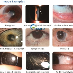 Système d'imagerie professionnel pour lampe à fente numérique, Microscope numérique à fente 5 grossissements Série SL-OVS - Product Image 6