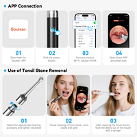 Extracteur électrique rechargeable en silicone pour l'élimination des calculs amigdalaires et de la pierre de la gorge – Outil de soin buccal domestique