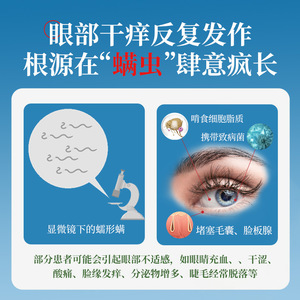 Toallitas de aceite de pino Super Asia, 20 unidades, pañuelos limpiadores para el cuidado de los ojos, para aliviar la sequedad ocular - Product Image 5