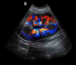 EC giá tốt Z60 bác sĩ thú y kỹ thuật số hệ thống siêu âm 3D 4D tùy chọn xách tay thú y siêu âm DOPPLER màu <span class=keywords><strong>usg</strong></span> - Product Image 4