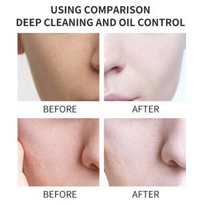 Limpiador <span class=keywords><strong>Facial</strong></span> Espumoso con Ácido Kójico, Colágeno, Vitaminas C y E, Limpieza Profunda, Exfoliante, Suave, No Irritante, para <span class=keywords><strong>Piel</strong></span> <span class=keywords><strong>Grasa</strong></span> - Product Image 4