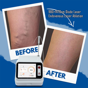 Máquina Endovascular Bjsunrise de 635nm 980nm 1470nm 30W para Várices, <span class=keywords><strong>Precio</strong></span> de la Máquina de Flebología - Product Image 1