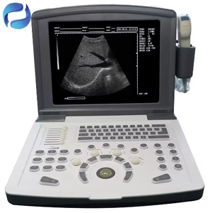 Échographe portable électrique pour grossesse, type ordinateur portable, pour cliniques, instruments d'échographie médicale avec garantie de <span class=keywords><strong>3</strong></span> ans - Product Image 1