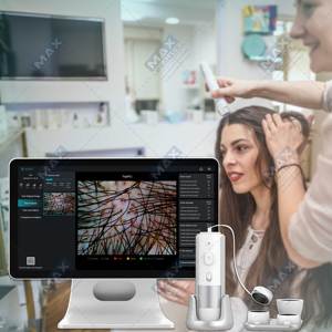 Maxbeauty yüksek kalite HD saç köklerinin kafa derisi tarayıcı dedektörü saç analizörü/cilt ve saç derisi saç analizi makinesi