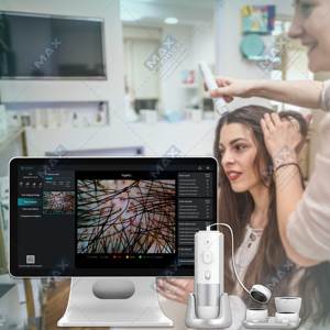 Maxbeauty Hoge Kwaliteit Hd Haarzakjes Hoofdhuid Scanner Detector Haaranalysator/Huid En Hoofdhuid Haaranalysemachine