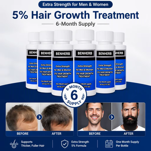5% Biotin Haarwuchs-Lösung 60ml USP-Formel für Männer Kopfhautpflege-Serum - Product Image 1
