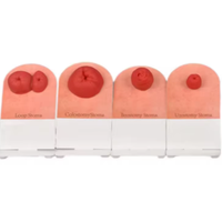 Nouveaux modèles de fistules de table en 4 types, modèles de formation pour les soins des stomies et la pratique de la fistule et de l'ostomie