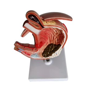 Modèle anatomique d'estomac malade pour l'enseignement médical, modèle de muqueuse gastrique, modèle de gastrite et d'ulcère - Product Image 6