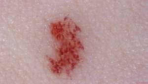 Dermatoscopio Polarizzatore per Dermatologi con Ugelli Sostituibili per iPhone iPad Android - Product Image 2