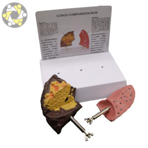 मानव फेफड़े चिकित्सा शिक्षण एनाटॉमी मॉडल - Product Image 2