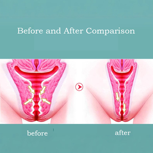 Cuidado <span class=keywords><strong>de</strong></span> las Partes Íntimas Femeninas, Líquido Antibacteriano y Contraíble - Product Image 4