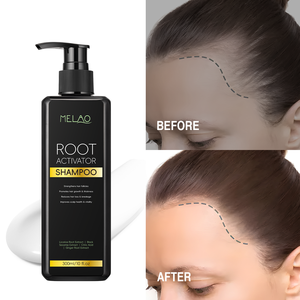 Private Label Organic Nourishing Scalp Root Activating Strengthening <b>Shampoo</b> for <b>Hair</b> Growth & Repair - Product Image 5