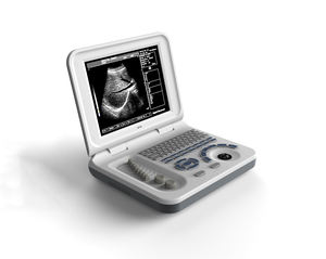 Scanner portatif d'ultrason avec l'imagerie à haute résolution, conception légère pour le diagnostic médical - Product Image 1