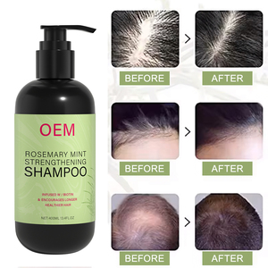 Champú fortalecedor de menta de romero con infusión Bio OEM Tratamiento de <span class=keywords><strong>alopecia</strong></span> del cuero cabelludo Kit de champú y acondicionador <span class=keywords><strong>para</strong></span> el crecimiento del cabello - Product Image 5