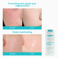 Sérum facial oligopeptide à marque privée, réparation de la barrière cutanée, hydratant, apaisant, liquide 10ml, fabrication OEM personnalisée