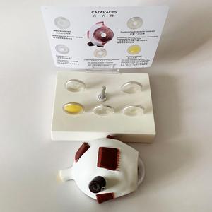Modelo Anatómico Ampliado del Ojo Humano con 5 <span class=keywords><strong>Tipos</strong></span> <span class=keywords><strong>de</strong></span> Lentes <span class=keywords><strong>de</strong></span> Catarata para <span class=keywords><strong>la</strong></span> Enseñanza <span class=keywords><strong>de</strong></span> Oftalmología - Product Image 2