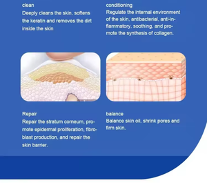 Máquina de Limpieza Facial de Burbujas 14 en 1, Venta Caliente 2024, Cuidado Facial con Oxígeno, Reafirmante, para Salón de Belleza y Spa - Product Image 5