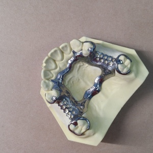 Imprimante 3D dentaire personnalisée pour la dentisterie, impression 3D rapide SLM, fabrication de prototypes, support - Product Image 4