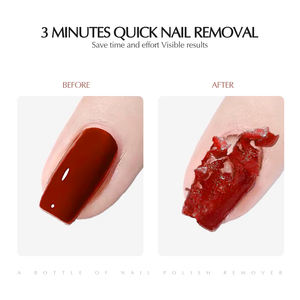 CHAORY - Removedor de Esmalte de Uñas en <span class=keywords><strong>Gel</strong></span> UV de 15 ml, Eliminación Rápida, Sin Daños, Removedor de <span class=keywords><strong>Gel</strong></span> Mágico de Acción Rápida para Uñas - Product Image 2