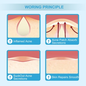 Patch hydrocolloïde de bouton de coeur rose d'Hysent pour le <span class=keywords><strong>produit</strong></span> clair de soin de peau de guérison d'<span class=keywords><strong>acné</strong></span> - Product Image 5