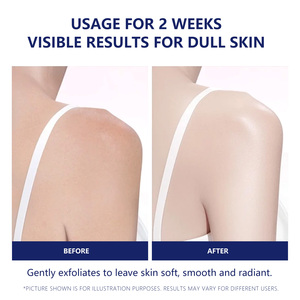 Aixin Private Label Improves Acne-Prone And Gentle Exfoliation Deeply Moisturizes Copper Peptide Exfoliating Scrub <strong>Soap</strong> - Product Image 6