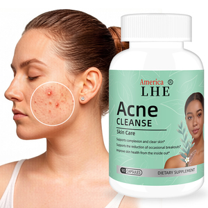 Suplemento para el Acné Shecome al por Mayor, Fabricante de Productos para la Claridad de la Piel con Vitamina A, Vitamina C, Zinc y Mezcla de Hierbas, 90 Cápsulas para el Acné - Product Image 1