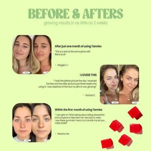 Suplemen <span class=keywords><strong>Tanning</strong></span> kulit kustom suplemen <span class=keywords><strong>Tanning</strong></span> Gummies kolagen <span class=keywords><strong>Tanning</strong></span> Gummies - Product Image 4