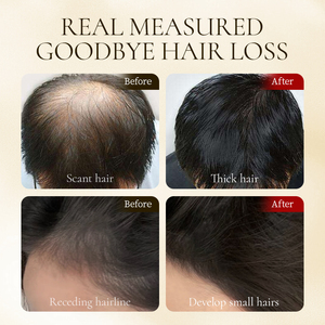 Dầu gội kích thích mọc tóc gừng bán chạy năm 2024, dưỡng sâu, làm sạch sâu, có tác dụng dưỡng ẩm và trị gàu - Product Image 2