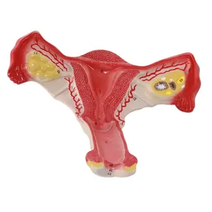 Modèle d'enseignement de l'anatomie utérine féminine, modèle anatomique de l'utérus - Product Image 5