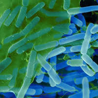 Bactéries dénitrifiantes en vrac pour usine, agent dénitrifiant tolérant à la salinité maximale de 6 % pour le traitement de la dénitrification des eaux usées