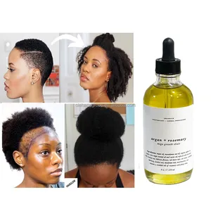 Private Label naturale a base di erbe cura del cuoio capelluto trattamento di perdita di capelli olio essenziale di rosmarino olio per la crescita dei capelli per le donne di colore