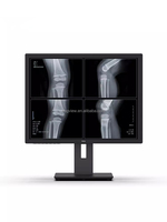 Nouveau 21.3 pouces 3Mega M écran vertical échelle de gris CT lecture X-ray DR radiologie diagnostic DICOM moniteur médical