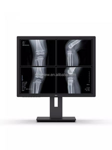 Neuer 21,3 Zoll 3Mega <span class=keywords><strong>M</strong></span> vertikaler Bildschirm Graustufen CT-Lesung Röntgen DR Radiologie Diagnose DICOM medizinischen Monitor - Product Image 5