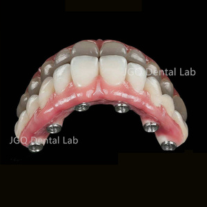 Prothèses dentaires sécurisées sur implant Ponts en zircone Arc complet Chine Laboratoire <span class=keywords><strong>dentaire</strong></span> <span class=keywords><strong>Prix</strong></span> compétitif - Product Image 4