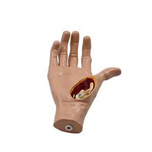 Démonstrato clinique de main de simulateur de pathologie pour l'enseignement orthopédique et rhumatologique - Product Image 2