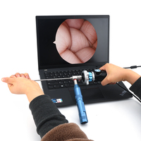 Système de caméra endoscopique portable d'usine Full HD USB Endoscope médical pour ordinateur portable PC Caméra endoscopique rigide ORL