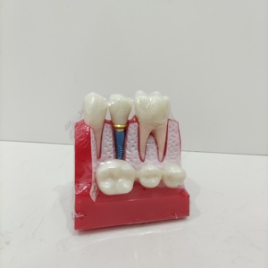 معدات تدريس تشريحية للعلوم الطبية تمرين محاكاة الأسنان عن طريق الفم نموذج زرع الأسنان البشري لدراسة الطلاب - Product Image 3