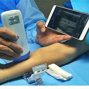 Factory Offer OEM&ODM&SDK Service for <b>Android</b> Wireless Linear and Convex Probe Ultrasound Scanner - Product Image 6