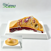 Modelo Anatómico Patológico de Seno Humano SCIEDU, Sección Transversal de Anatomía del Seno Humano, Modelo Anatómico de Seno Femenino