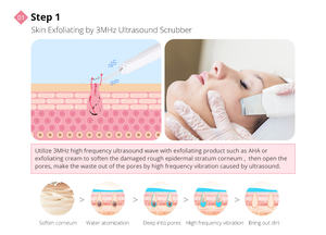 Mychway Gesichtspflege Ultra + Hautpeeling + Kaltes und Heißes Hammer Diamant-Dermabrasionsgerät - Product Image 3