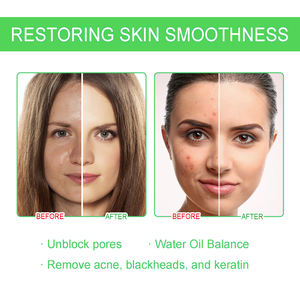 OEM Doğal Cilt Bakımı Yüz Serumu Anti Akne Gözenek Sıkılaştırıcı Peeling Etkili %2 BHA Akne Salisilik Asit Yüz Serumu - Product Image 3