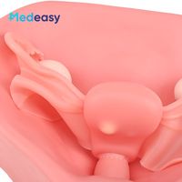 Modèle de module utérin féminin avec utérus, col de l'utérus et vagin, simulation d'environnement pelvien avec fibrome et gonflement