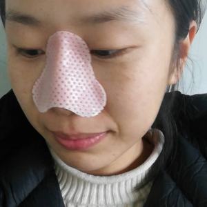 Wiederaufziehbares Polymermaterial externe temperaturpflege-Nasenbandage Splint für Nasenwirbel Chirurgie Frakturrehabilitation - Product Image 2