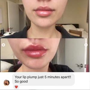 Bán Sỉ Dụng Cụ Làm Đầy Môi Son Bóng Cho Người Ăn Chay Dụng Cụ Làm Đầy Môi Dầu Dưỡng Ẩm Cho Môi - Product Image 5