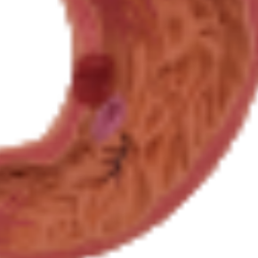 Modèle de Pathologie Gastrique D021F/D021G pour l'enseignement et l'apprentissage de l'Anatomie en Sciences Médicales pour la Formation des Infirmières - Product Image 3