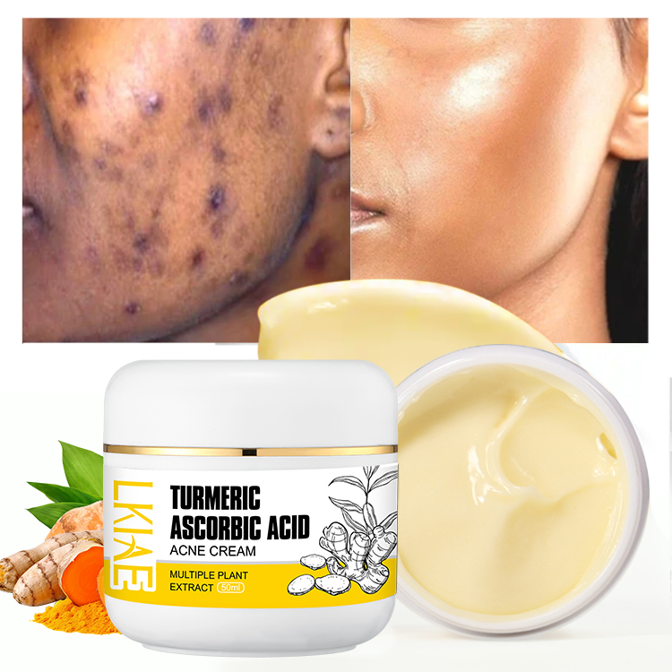 Boost Luster Turmeric Herbal Face Cream Whitening and Acne Removal Pimple Face Anti Acne Cream