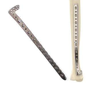 CANWELL Placa de bloqueo de perfil bajo para tibia distal, sistema de fijación por compresión metafisal de titanio, para traumatología ortopédica, CE ISO - Product Image 1