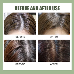 Champú y acondicionador Vegano para el cabello, nuevo estilo, logotipo personalizado, champú orgánico <span class=keywords><strong>de</strong></span> <span class=keywords><strong>sal</strong></span> marina Centella, exfoliante para el cuero cabelludo - Product Image 3