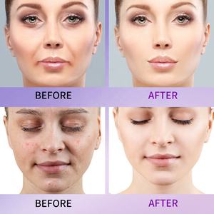 Set Cura della Pelle DRL-1724 Siero Liquido Vitamina <span class=keywords><strong>C</strong></span> Anti-Età e Sbiancante Giorno e Notte per Corpo e Viso 60ml - Product Image 3